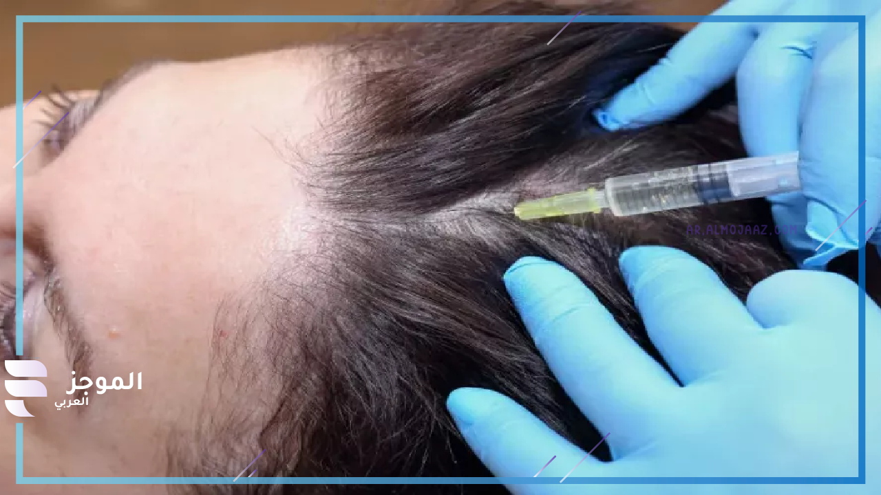 متى يظهر مفعول الخلايا الجذعية للشعر