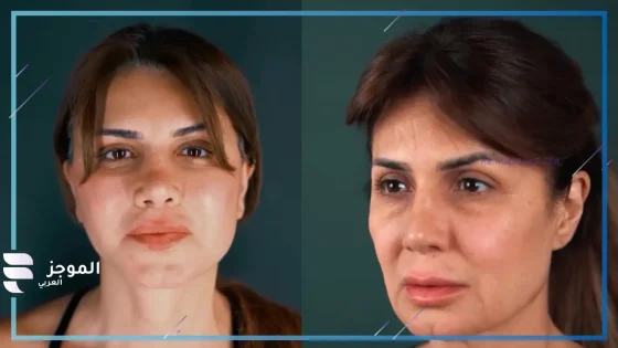 بملامح مختلفة.. نجلاء بدر تُثير الجدل بعد خضوعها لعملية تجميل في الوجه