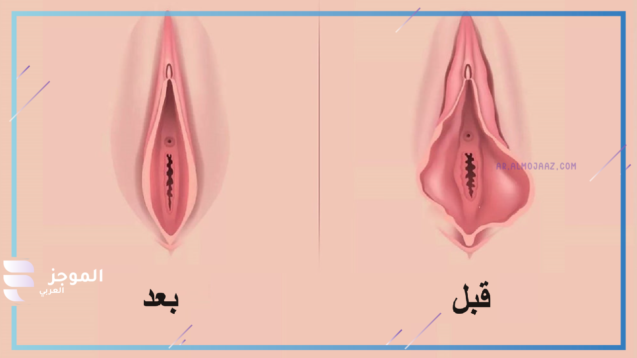 متى يلتئم بعد قص الشفرات