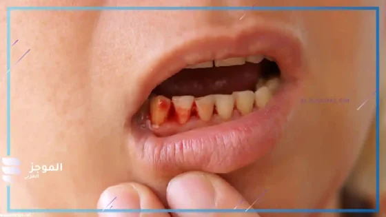 تفسير حلم خروج الدم من الفم للعزباء